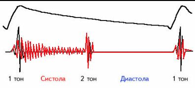 sist-ub.jpg (24326 bytes)