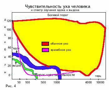 uxo3.jpg (39635 bytes)