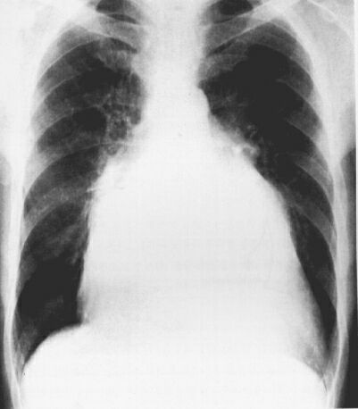 Mr_cxr.jpg (83072 bytes)