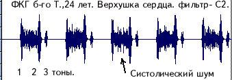 pcg-1.jpg (11955 bytes)