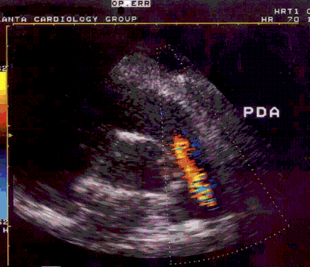 pda-1.gif (42254 bytes)