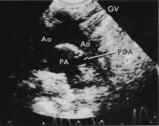 pda_2d.jpg (14257 bytes)