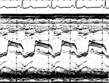 Ms_m.jpg (87366 bytes)
