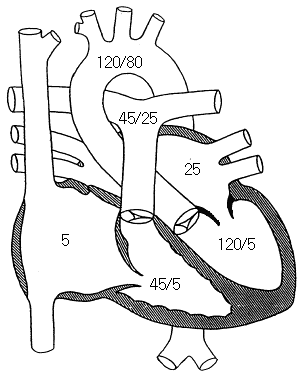 ms.gif (14791 bytes)