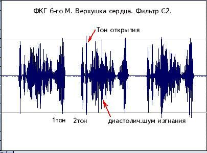 pcg-2.jpg (25027 bytes)