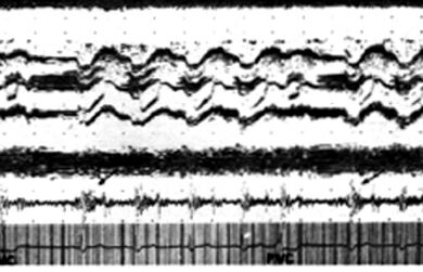 As_m.jpg (65957 bytes)
