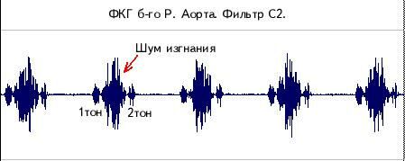 pcg4.jpg (14806 bytes)