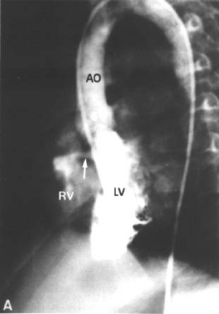 Vsd_ang.jpg (66113 bytes)